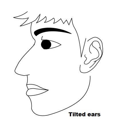 tilted ears